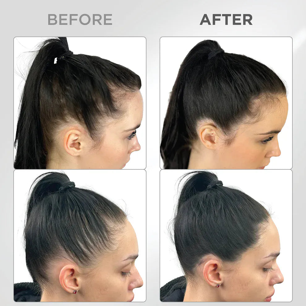 Líora Hair