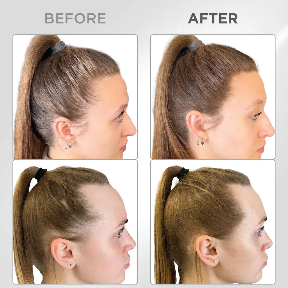 Líora Hair