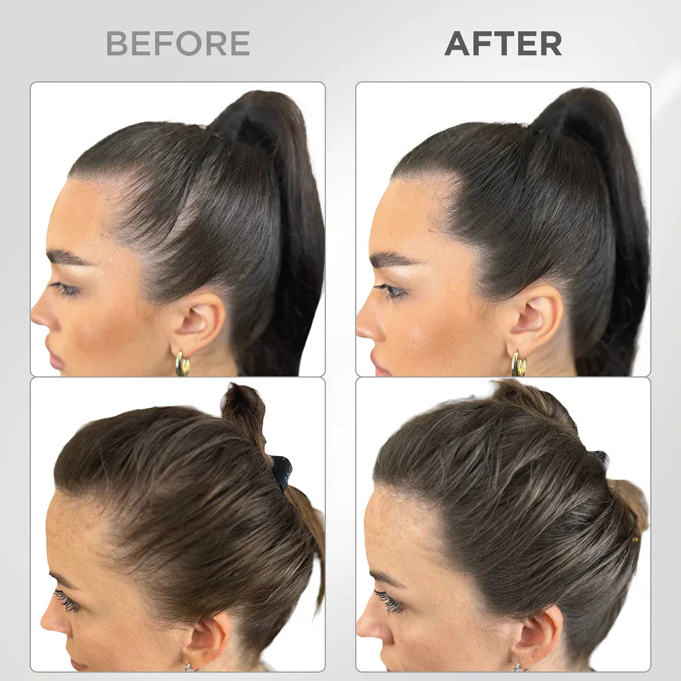 Líora Hair