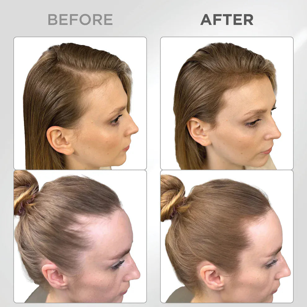 Líora Hair