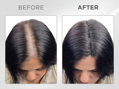 Líora Hair